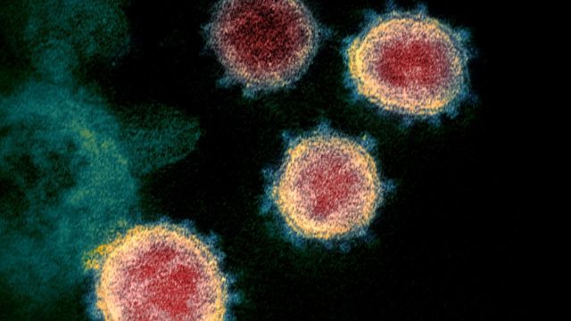 ویروس کرونایی که به بیماری کووید-۱۹ منجر می‌شود با ویروس سارس نقاط مشترک دارد و مشخص شده که باعث تولید سلول‌های تی می‌شود