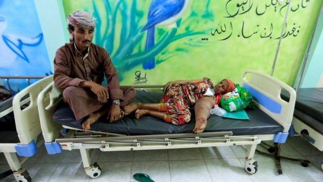 بیماران سرطانی در یمن از درمان لازم محرومند
