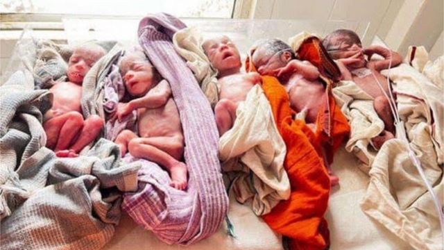 रांची के रिम्स अस्पताल में एक महिला ने एक साथ पांच बेटियों को जन्म दिया है