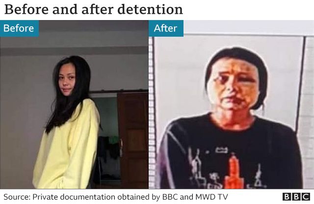 Before and after picture of a woman detainee, showing her face badly beaten