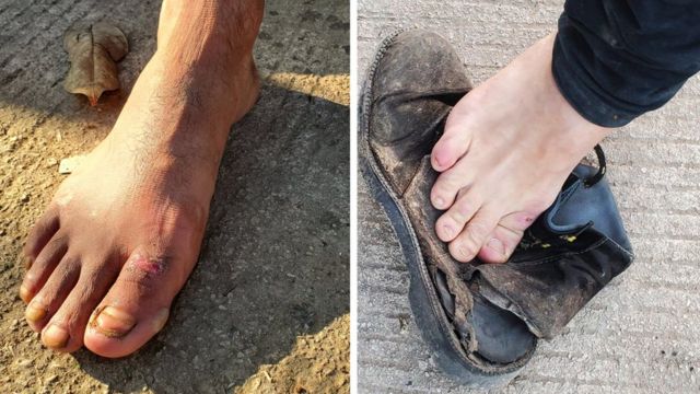 This is how the feet and shoes of many migrants look after hours of walking