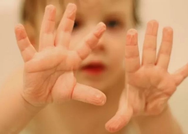 Wrinkled hands of a child