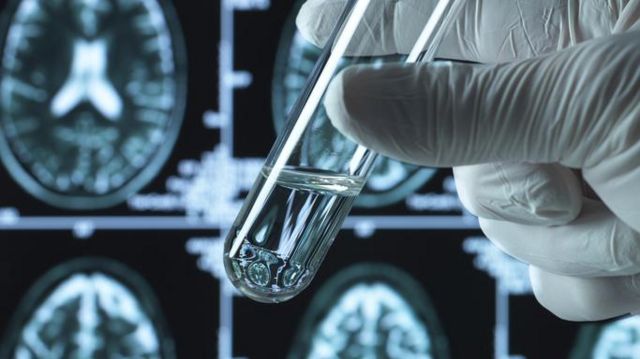 Scientist holding liquid with brain images in the background
