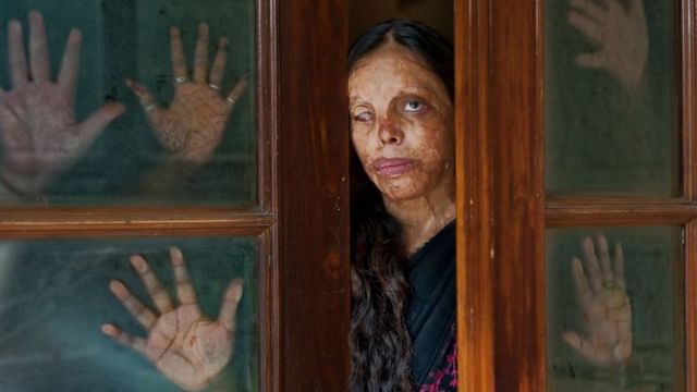 An acid attack survivor behind the window