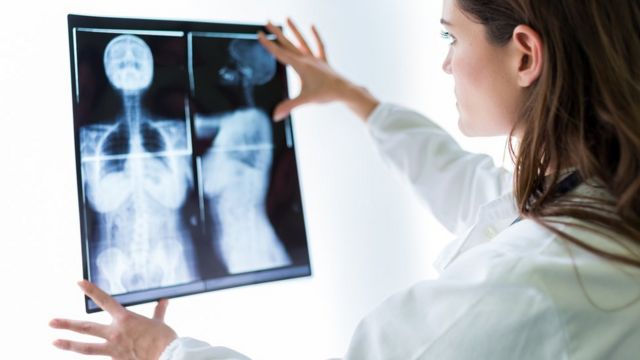 Médica mirando una radiografía
