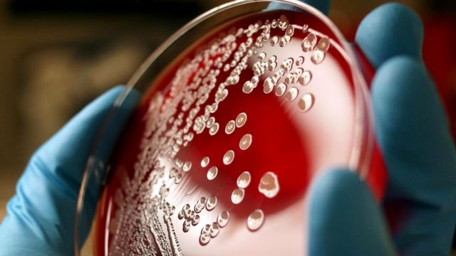 Под каждым ногтем могут жить сотни тысяч бактерий