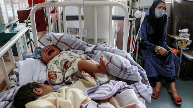 Mulher sentada ao lado de bebês após ataque suicida no Afeganistão