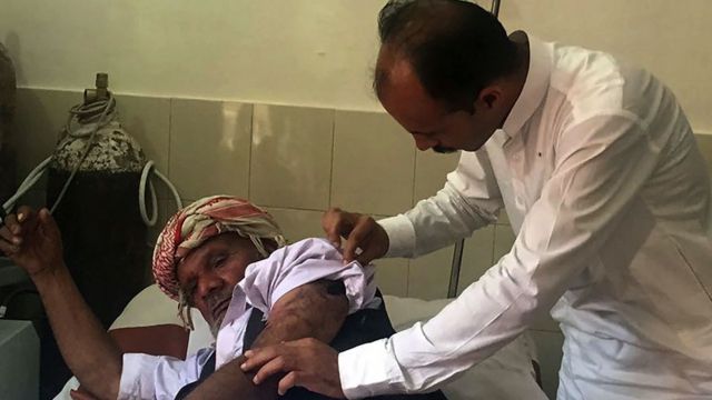 भारतीय सीमा की ओर से हुई गोलीबारी में घायल व्यक्ति मंगलवार को पाकिस्तान प्रशासित कश्मीर के नेज़ापीर सेक्टर के एक अस्पताल में इलाज करवाते हुए.