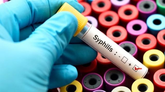 Examen de sífilis