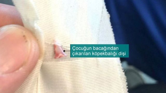 Köpekbalığı saldırısı