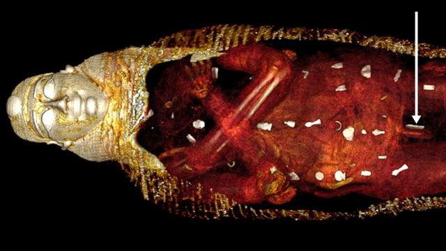 mummified body of a wealthy ancient Egyptian “golden boy” from 2,300 years ago and found 49 amulets of 21 different types on him