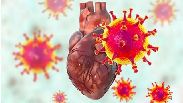 கொரோனா மற்றும் கார்டியாக் அரெஸ்டுக்கு தொடர்பு