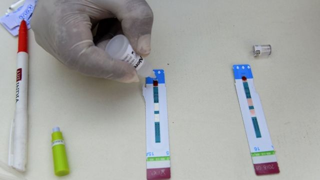 Scientists Don Discover New Antibody To Treat Hiv Bbc News Pidgin 6523