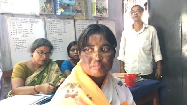 সালমা বেগম তাঁর স্মৃতি ফিরে পেয়েছেন। এখন বাংলাদেশে ফেরার দিন গুনছেন।
