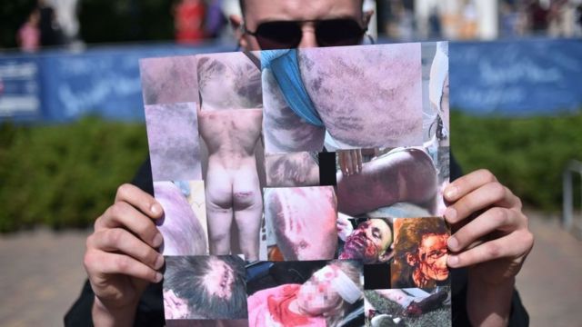 Мужчина держит плакат с фотографиями фрагментов тел избитых протестующих