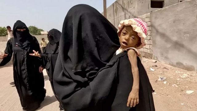 زنان و کودکان آسیب‌پذیر در یمن