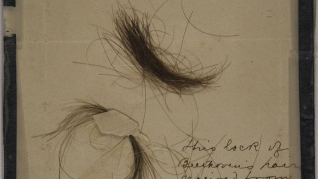 حدود دو قرن پس از مرگ لودویگ فان بتهوون٬ موسیقی‌دان و آهنگساز برجسته آلمانی محققان با انجام آزمایش روی موهای او به یافته‌هایی در مورد علت مرگ و وضعیت سلامتی او دست یافتند.