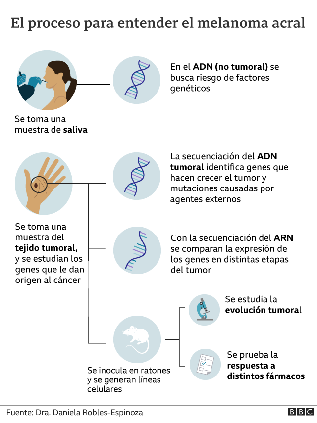 Melanoma acral