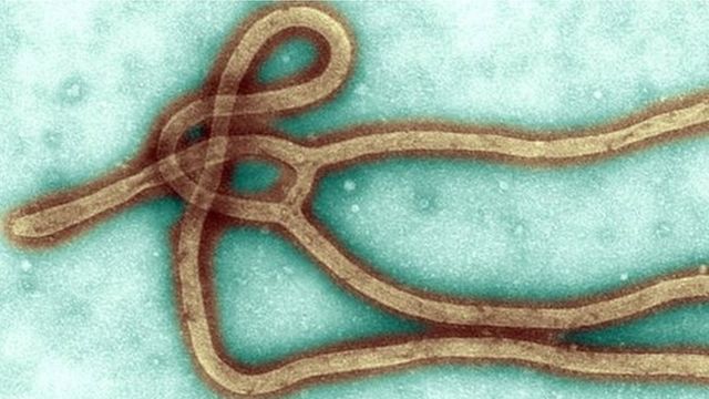 Vírus do ebola