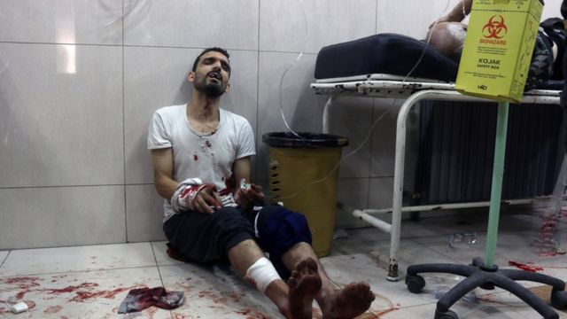 توقفت أغلب مستشفيات حلب عن تقديم الخدمات العلاجية بسبب القصف المتواصل