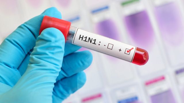 Tubo con etiqueta que marca resultado positivo para H1N1