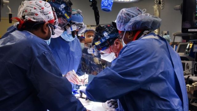 The team of surgeons during the operation.