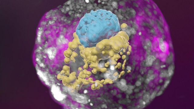 A stem cell–derived human embryo model at a developmental stage equivalent to that of a day 14