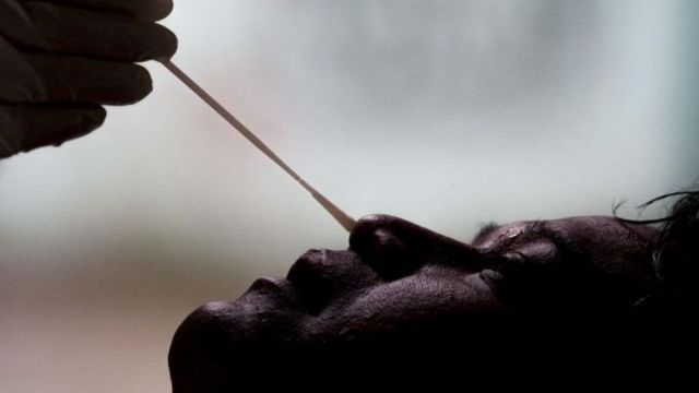 स्वाब सङ्कलन