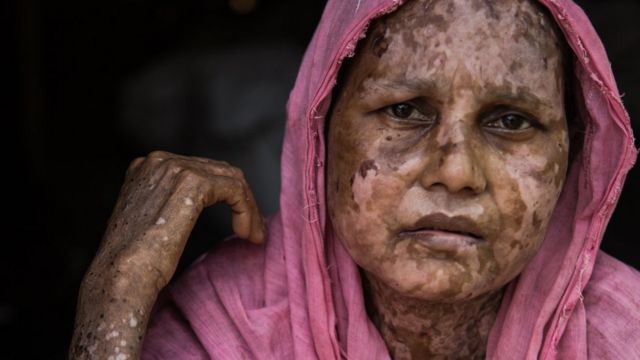 সারা বেগম, ৪০, বর্মী বাহিনীর অগ্নিসংযোগের শিকার