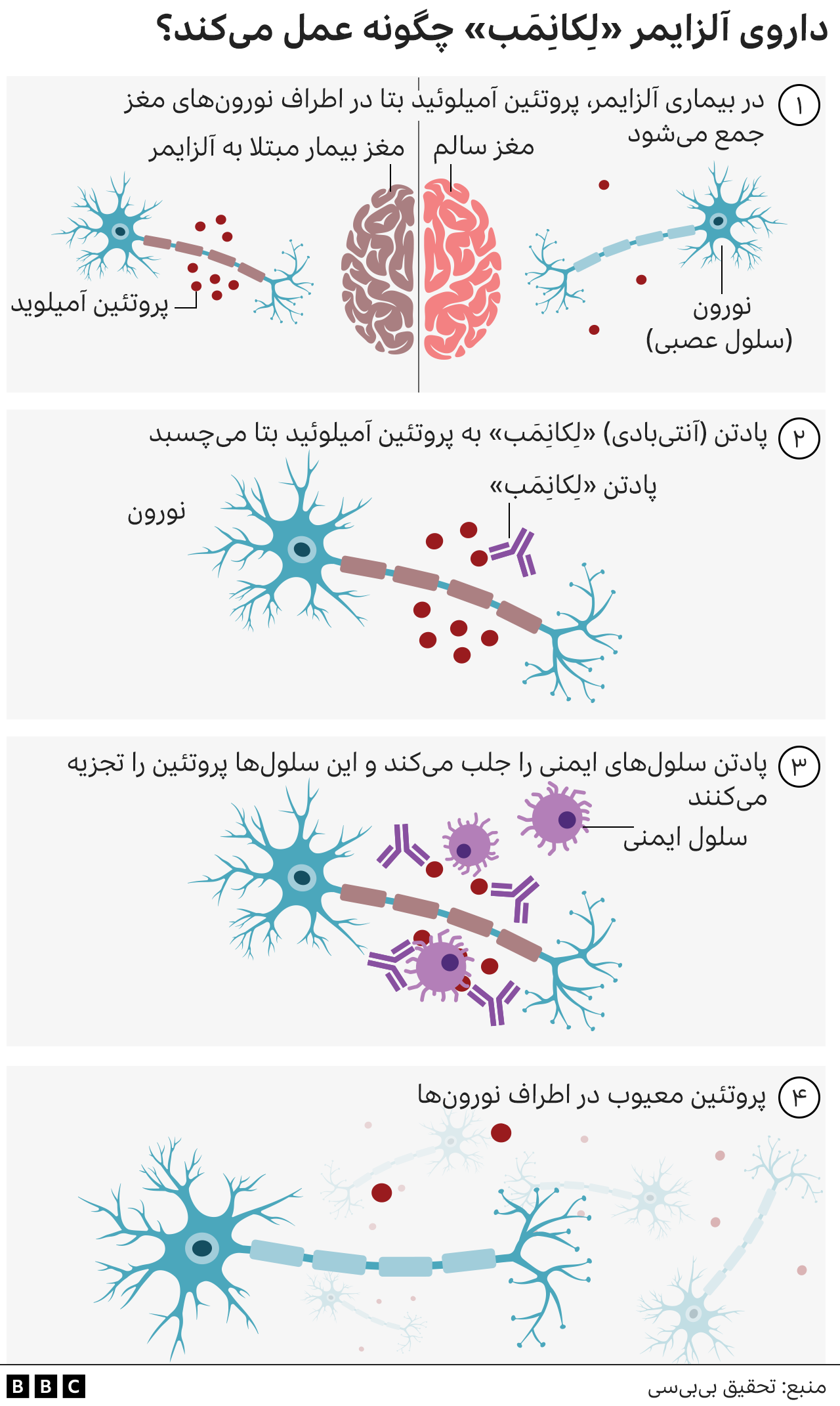 الزایمر