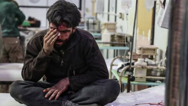 Homem ferido em hospital em Ghouta