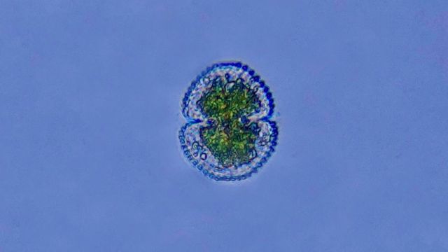 在积水中有单细胞生命体(photo:BBC)