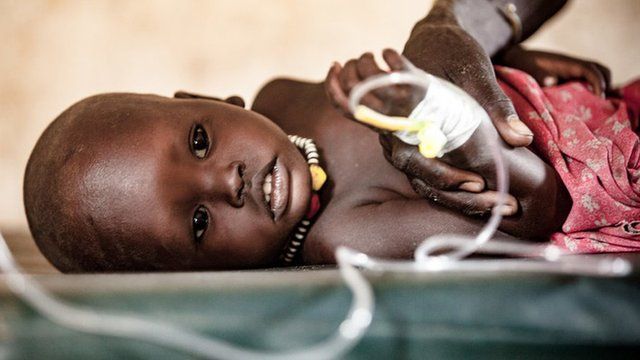One year-old Hakaroom is treated for severe pneumonia at a health care centre supported by Save the Children in Kapoeta North, South Sudan.