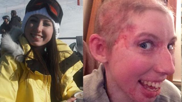 What Happened To French Alps Crash Survivor Catrin Pugh? Gain Insight Into Her Story & Accident  