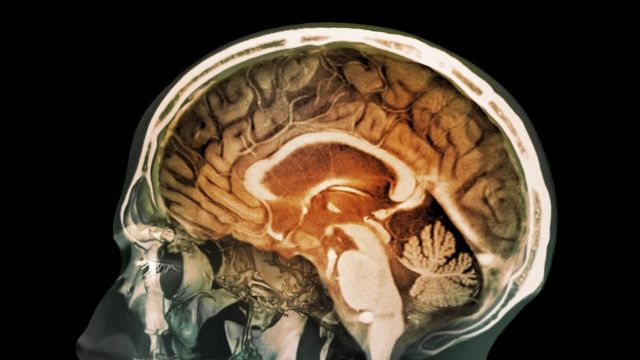 Brain