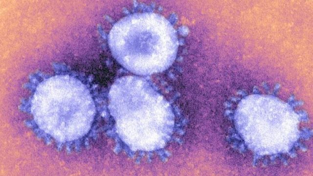 Ibaye igihugu cya kane cyo munsi y'ubutayu bwa Sahara gitangaje umuntu wa mbere wanduye coronavirus