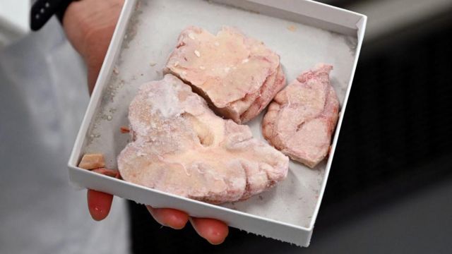 மனித மூளை