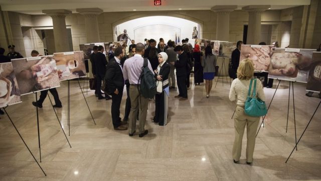 Выставка фотографий, вывезенных из Сирии и документирующих свидетельства пыток, совершенных режимом Асада