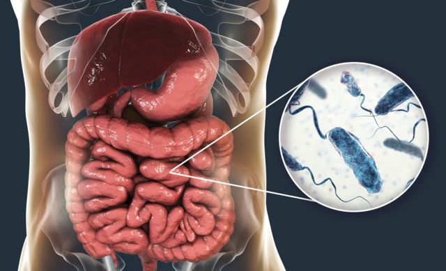 رسم يوضح جرثومة الكوليرا في الأمعاء