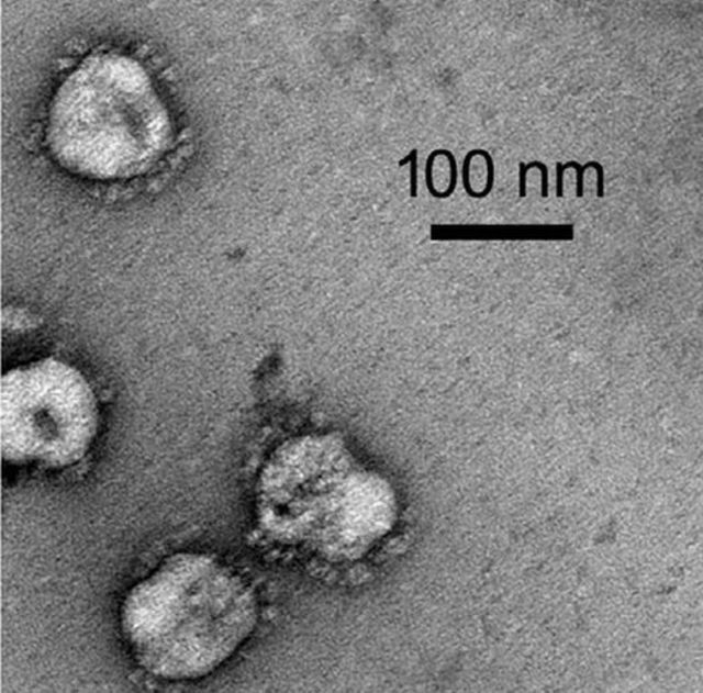 تصویر ویروس کرونایی که واکسن سینوفارم بر اساس آن ساخته شده (زیر میکروسکوپ الکترونی)