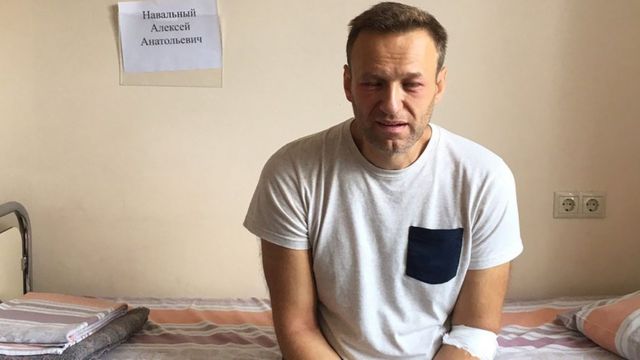 Navalny con el rostro hinchado