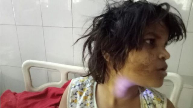 बंदरों के साथ रहनेवाली वाली लड़की
