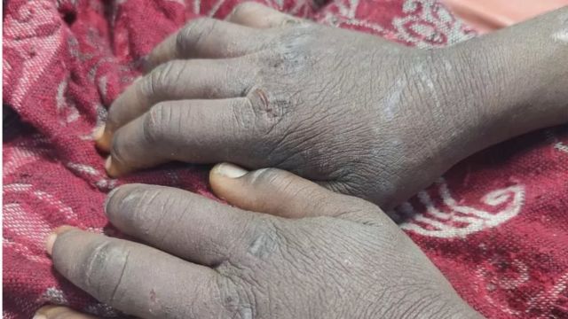 தென்சாசி சம்பவம்