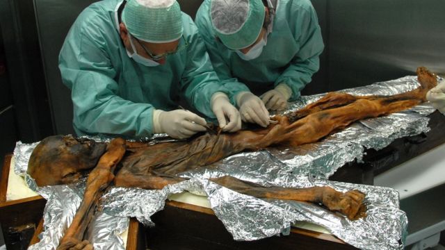 Médicos examinado múmia em Bolzano, na Itália