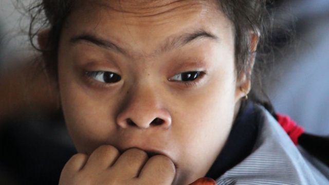 ஆட்டிசம்