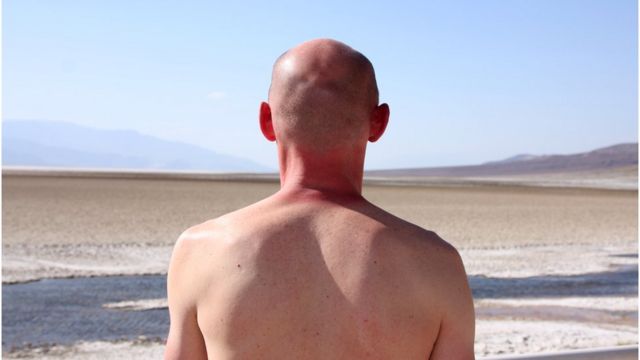 A man exposes his body to direct sunlight