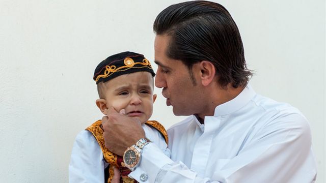 İran, uşaq bezi, bez qıtlığı, İran realı