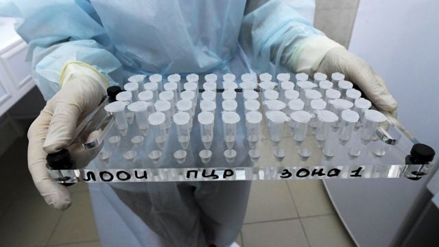 Biologiste avec des acides nucléiques isolés à partir d'échantillons humains pour être testés pour l'infection par le coronavirus Covid-19.