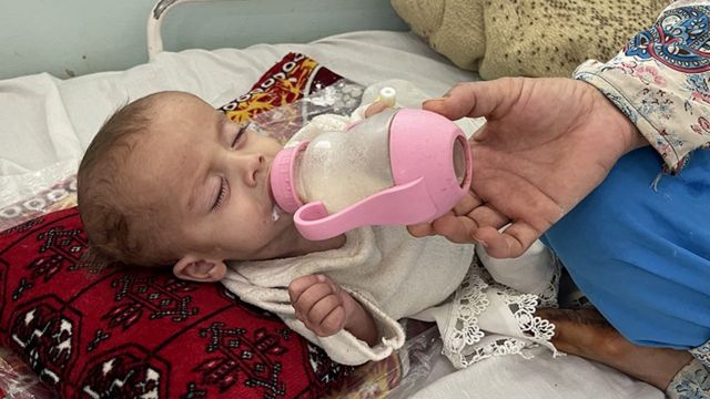 طفل يتلقى العلاج الطبي في مستشفى مير فيز في قندهار ، أفغانستان ، 28 أكتوبر/تشرين الأول 2021