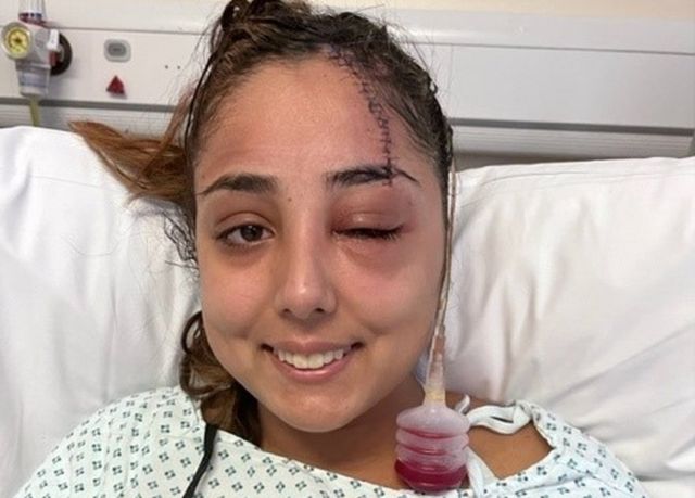 My hair clip lodged into my head in a car crash: 'Thought I was going to  die